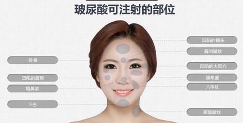 广州远东医院·面部轮廓整形医生有哪些？隆鼻真人案例、专业技术介绍！
