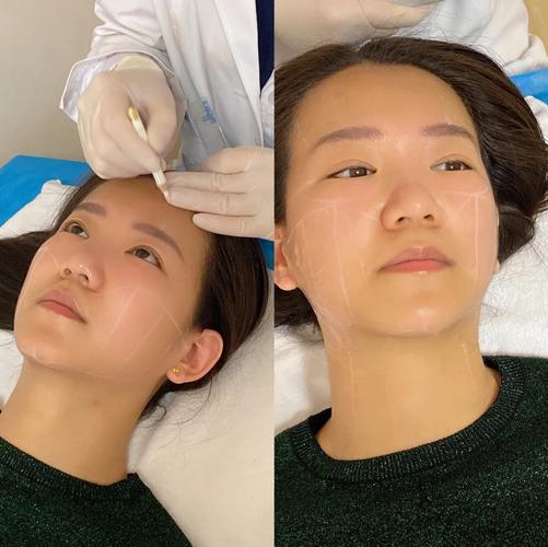 广州天姿医学美容整形科怎么样？医院资质-隆胸价格表全面解析！