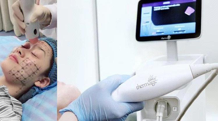 济南集美整形鼻部整形价格表全解析，真实隆鼻案例效果对比图展示