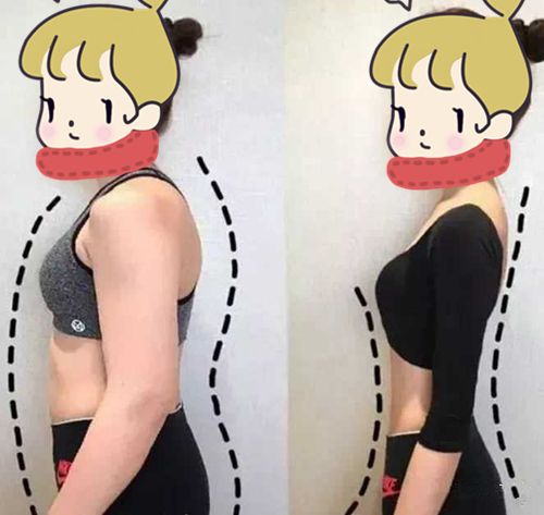 杭州比较好的抽脂医院哪家好？星颜、冰美、美天美等排行前五