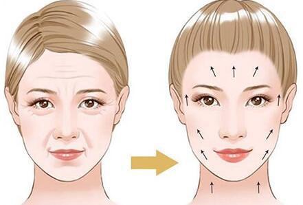 武汉抗衰除皱哪家医院技术好？2025年权