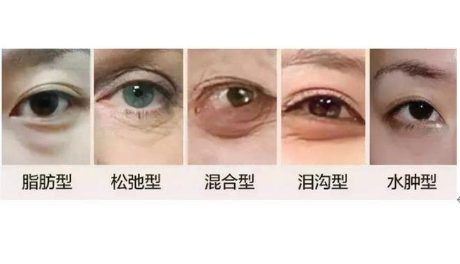 北京哪些医院做眼部整形手术好？2025年