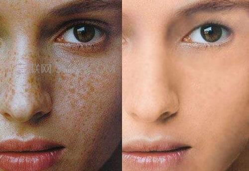 大连祛斑美容医院哪家效果好？这份权威榜单值得收藏！