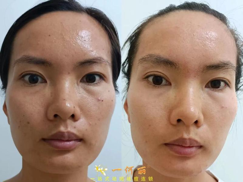 安阳蓝馨医疗美容整形科怎么样？专家团队与价格明细解析
