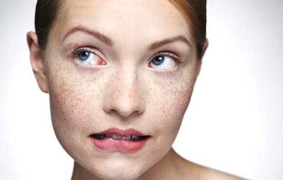 赣州激光祛斑整形医院排名，2025最新权