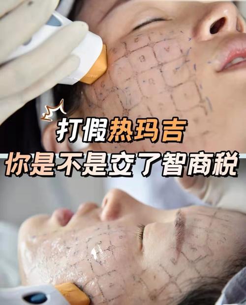 四平整形美容医院排名：专业医师团队护航，美丽蜕变更安心！