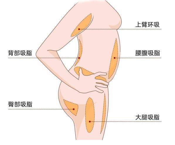 郑州吸脂整形医院排名，普瑞眼科、芳艺、集美等口碑佳