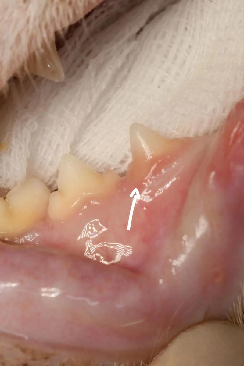 天津市第一中心医院口腔科怎么样？牙齿种植+口腔整形项目详解与真实案例分享