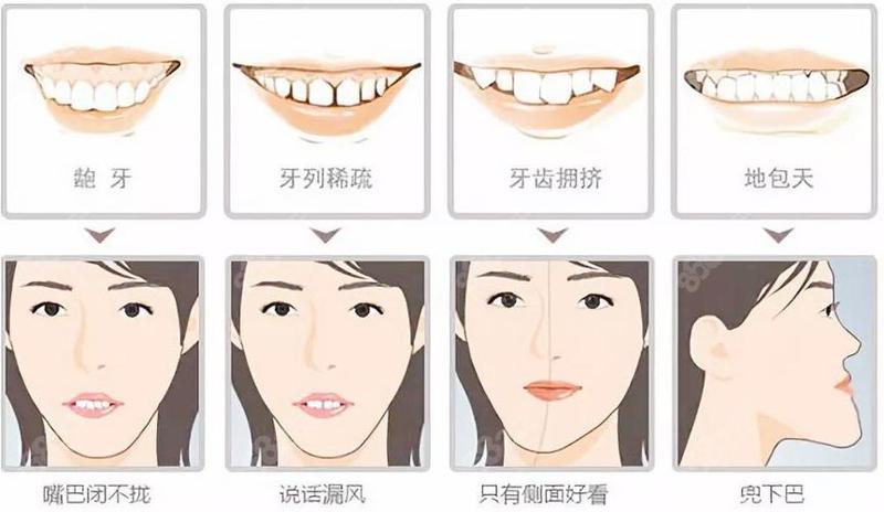 成都牙齿矫正口碑医院有哪些？2025年专