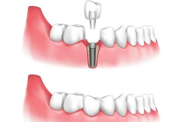 沈阳正规口腔整形医院排名推荐：专业医生团
