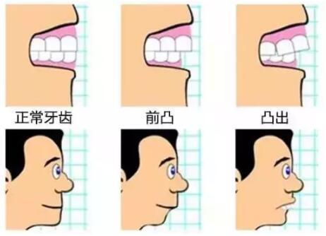 沈阳口腔整形医院哪家好？2025年最新医院排名与医生推荐