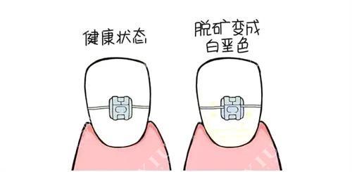 深圳牙齿矫正整形医院哪家好？协和深圳医院、深圳大学总医院、泰禾医疗等专业评测