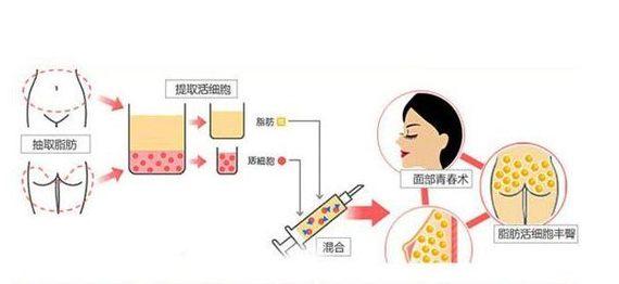 福州权威整形医院排名，2025最新榜单揭