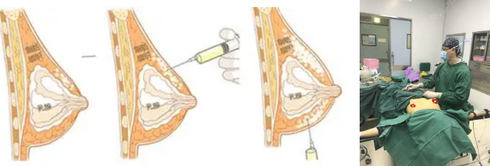 太原隆胸正规医院排名，五家专业机构各具特