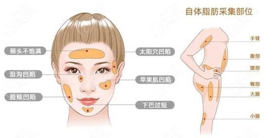 赣州东方薇琳医疗美容医院隆胸技术怎么样？